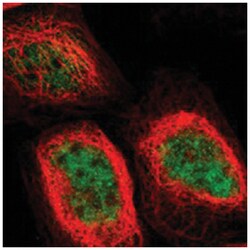 GMEB2, Rabbit, Polyclonal Antibody, Abnova 100&mu;L; Unlabeled:Antibodies,