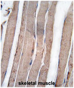 DAPK1, Rabbit, Polyclonal Antibody, Abnova 400 &mu;L | Buy Online | Abnova Corporation | Fisher Scientific