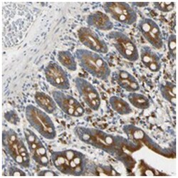 IER3IP1, Rabbit, Polyclonal Antibody, Abnova 100 &mu;L | Buy Online | Abnova Corporation | Fisher Scientific