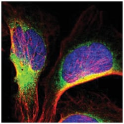 IER3IP1, Rabbit, Polyclonal Antibody, Abnova 100 &mu;L | Buy Online | Abnova Corporation | Fisher Scientific