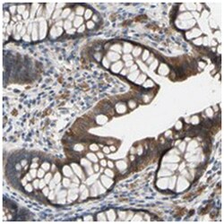 GRAMD3 Rabbit anti-Human, Polyclonal Antibody, Abnova 100&mu;L; Unlabeled:Antibodies,