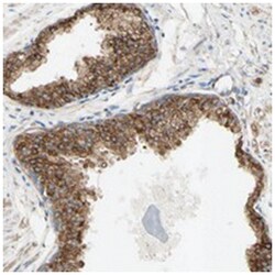 ENDOD1 Rabbit anti-Human, Polyclonal Antibody, Abnova 100 &mu;L | Buy Online | Abnova | Fisher Scientific