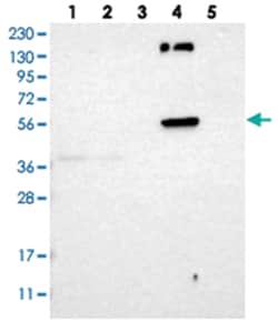 GLT8D1, Rabbit, Polyclonal Antibody, Abnova 100 &mu;L | Buy Online | Abnova | Fisher Scientific