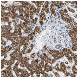 GLT8D1, Rabbit, Polyclonal Antibody, Abnova 100 &mu;L | Buy Online | Abnova | Fisher Scientific