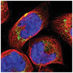 GLT8D1, Rabbit, Polyclonal Antibody, Abnova 100 &mu;L | Buy Online | Abnova | Fisher Scientific