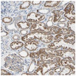 FAM163A Rabbit anti-Human, Polyclonal Antibody, Abnova 100μL; Unlabeled:Antibodies,
