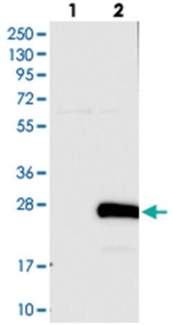 FAM163A Rabbit anti-Human, Polyclonal Antibody, Abnova 100μL; Unlabeled:Antibodies,