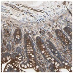 IGSF9B, Rabbit, Polyclonal Antibody, Abnova 100 &mu;L | Buy Online | Abnova Corporation | Fisher Scientific