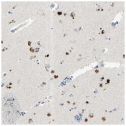 B4GALT1 Rabbit anti-Human, Polyclonal Antibody, Abnova 100 &mu;L | Buy Online | Abnova Corporation | Fisher Scientific