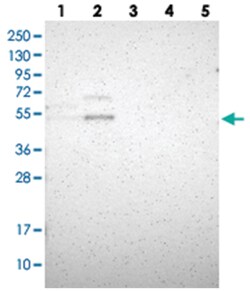 B4GALT1 Rabbit anti-Human, Polyclonal Antibody, Abnova 100 &mu;L | Buy Online | Abnova Corporation | Fisher Scientific