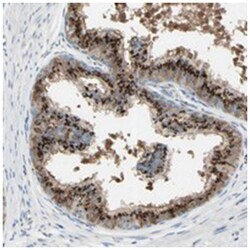 B4GALT1 Rabbit anti-Human, Polyclonal Antibody, Abnova 100 &mu;L | Buy Online | Abnova Corporation | Fisher Scientific