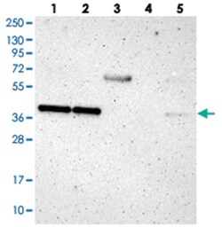 DNAJB11 Rabbit anti-Human, Mouse, Rat, Polyclonal Antibody, Abnova 100&mu;L;