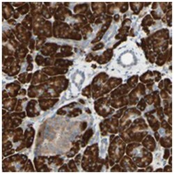 DNAJB11 Rabbit anti-Human, Mouse, Rat, Polyclonal Antibody, Abnova 100&mu;L;