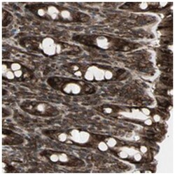 FXYD5, Rabbit, Polyclonal Antibody, Abnova 100&mu;L; Unlabeled:Antibodies,