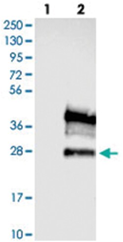 FXYD5, Rabbit, Polyclonal Antibody, Abnova 100&mu;L; Unlabeled:Antibodies,