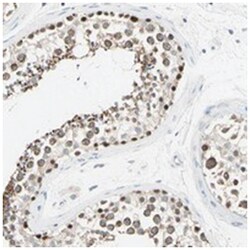 MFF, Rabbit, Polyclonal Antibody, Abnova 100&mu;L; Unlabeled:Antibodies,