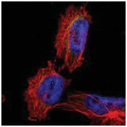 MFF, Rabbit, Polyclonal Antibody, Abnova 100&mu;L; Unlabeled:Antibodies,