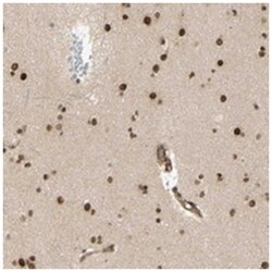 ZMYM6, Rabbit, Polyclonal Antibody, Abnova 100&mu;L; Unlabeled:Antibodies,