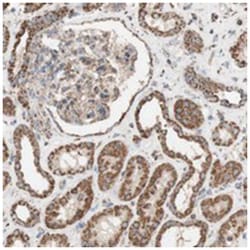 SYT12, Rabbit, Polyclonal Antibody, Abnova 100 &mu;L | Buy Online | Abnova Corporation | Fisher Scientific