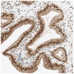 ZNF782, Rabbit, Polyclonal Antibody, Abnova 100&mu;L; Unlabeled:Antibodies,