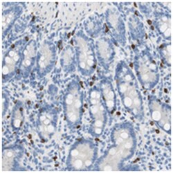 CEACAM3, Rabbit, Polyclonal Antibody, Abnova 100&mu;L; Unlabeled:Antibodies,