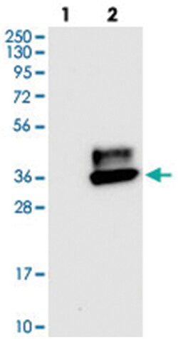 CEACAM3, Rabbit, Polyclonal Antibody, Abnova 100&mu;L; Unlabeled:Antibodies,