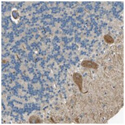 NEXN, Rabbit, Polyclonal Antibody, Abnova 100&mu;L; Unlabeled:Antibodies,