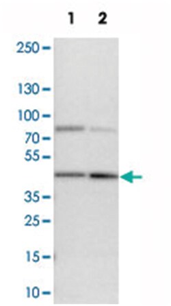 ERLIN1, Rabbit, Polyclonal Antibody, Abnova 100&mu;L; Unlabeled:Antibodies,