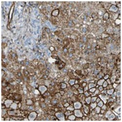 HSPA12A, Rabbit, Polyclonal Antibody, Abnova 100 &mu;L | Buy Online | Abnova Corporation | Fisher Scientific