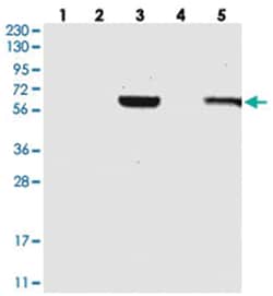 C1RL, Rabbit, Polyclonal Antibody, Abnova 100&mu;L; Unlabeled:Antibodies,