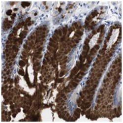 C1RL, Rabbit, Polyclonal Antibody, Abnova 100&mu;L; Unlabeled:Antibodies,