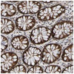 CCDC51 Rabbit anti-Human, Polyclonal Antibody, Abnova 100&mu;L; Unlabeled:Antibodies,