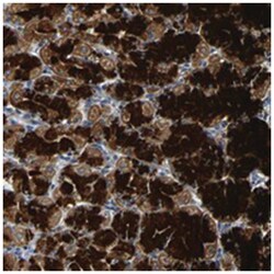 MTX1, Rabbit, Polyclonal Antibody, Abnova 100 &mu;L | Buy Online | Abnova Corporation | Fisher Scientific