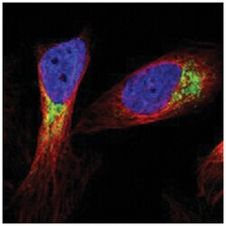 MTX1, Rabbit, Polyclonal Antibody, Abnova 100 &mu;L | Buy Online | Abnova Corporation | Fisher Scientific