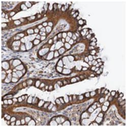 ST8SIA6, Rabbit, Polyclonal Antibody, Abnova 100&mu;L; Unlabeled:Antibodies,