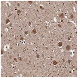 SEZ6, Rabbit, Polyclonal Antibody, Abnova 100&mu;L; Unlabeled:Anticuerpos