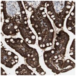 C1orf116 Rabbit anti-Human, Polyclonal Antibody, Abnova 100&mu;L; Unlabeled:Antistoffer