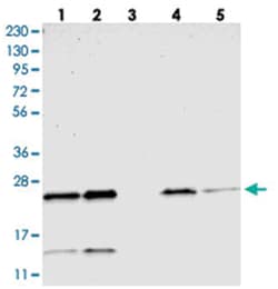 CCDC90B Rabbit anti-Human, Polyclonal Antibody, Abnova 100 &mu;L | Buy Online | Abnova Corporation | Fisher Scientific