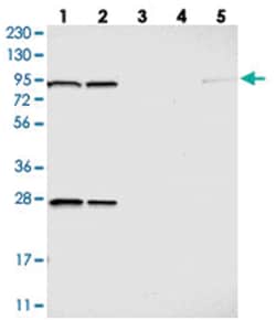 GCS1 Rabbit anti-Human, Polyclonal Antibody, Abnova 100 &mu;L | Buy Online | Abnova Corporation | Fisher Scientific