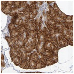 GCS1 Rabbit anti-Human, Polyclonal Antibody, Abnova 100 &mu;L | Buy Online | Abnova Corporation | Fisher Scientific