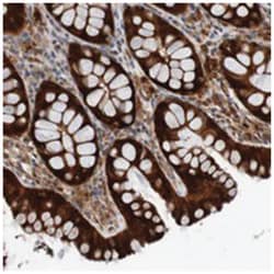 C7orf58, Rabbit, Polyclonal Antibody, Abnova 100&mu;L; Unlabeled:Antibodies,