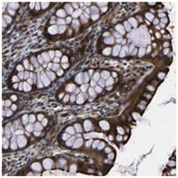 PARP14 Rabbit anti-Human, Polyclonal Antibody, Abnova 100 &mu;L | Buy Online | Abnova Corporation | Fisher Scientific