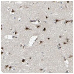 JHDM1D, Rabbit, Polyclonal Antibody, Abnova 100 &mu;L | Buy Online | Abnova Corporation | Fisher Scientific