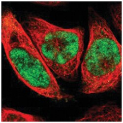 JHDM1D, Rabbit, Polyclonal Antibody, Abnova 100 &mu;L | Buy Online | Abnova Corporation | Fisher Scientific