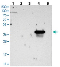TMEM25, Rabbit, Polyclonal Antibody, Abnova 100&mu;L; Unlabeled:Antibodies,