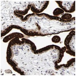 P11, Rabbit, Polyclonal Antibody, Abnova 100&mu;L; Unlabeled:Antibodies,