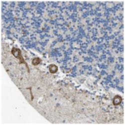 THSD1, Rabbit, Polyclonal Antibody, Abnova 100&mu;L; Unlabeled:Antibodies,