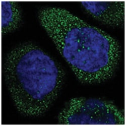 THSD1, Rabbit, Polyclonal Antibody, Abnova 100&mu;L; Unlabeled:Antibodies,