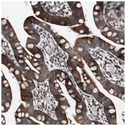 GALNT8, Rabbit, Polyclonal Antibody, Abnova 100&mu;L; Unlabeled:Antibodies,