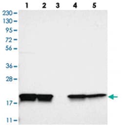 PPIB Rabbit anti-Human, Polyclonal Antibody, Abnova 100&mu;L; Unlabeled:Antibodies,